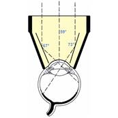 Ocular - 3 Miroirs Diagnostic – 18 mm