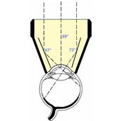 Ocular - 3 Miroirs Diagnostic et Laser – 20 mm avec collerette